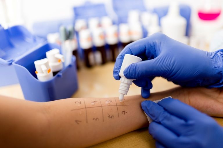 Кожным пробам на смену: ученые Университета Берна представили безболезненный тест на аллергию