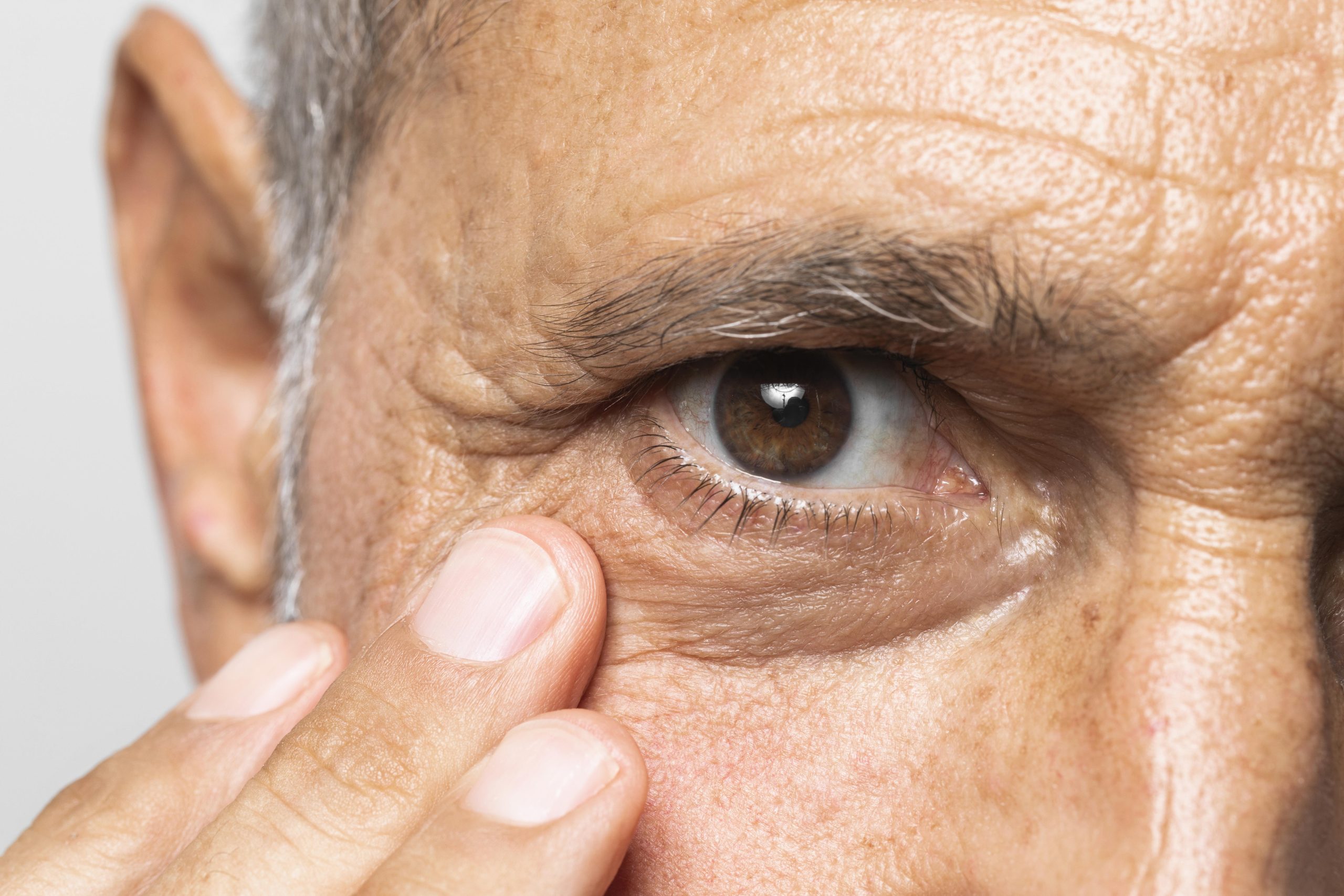 Лечение катаракты у пожилых людей операция. Пожилые люди с карими глазами.