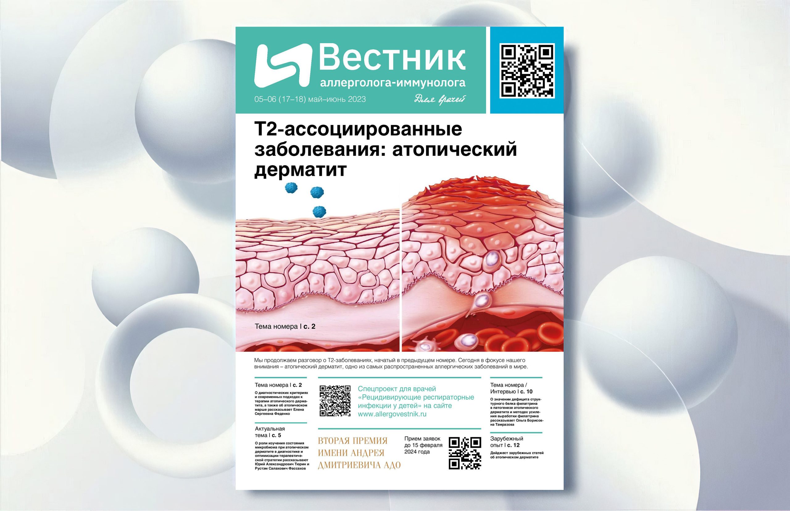 Т2-ассоциированные заболевания: атопический дерматит. Вышел новый номер  газеты «Вестник аллерголога-иммунолога» ⋆ Вестник аллерголога-иммунолога